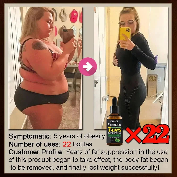 30ml Natural Weight Loss Oil for Women's Belly Fat Burning Stomach Fat Reducing Aid Fitness & Wellness Fat Burning Oil