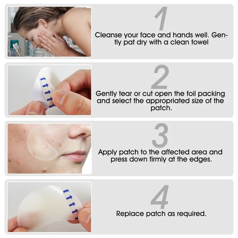 20 Patches Acne Patch Pimple Patches Blemish Protective Cover Absorbing Spot