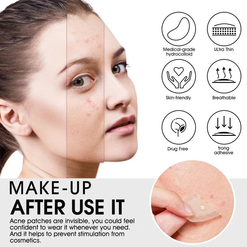 20 Patches Acne Patch Pimple Patches Blemish Protective Cover Absorbing Spot